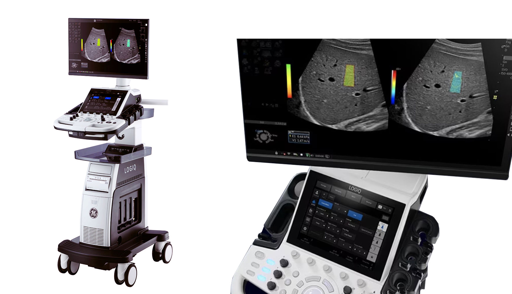 초음파장비 (LOGIQ P10)
